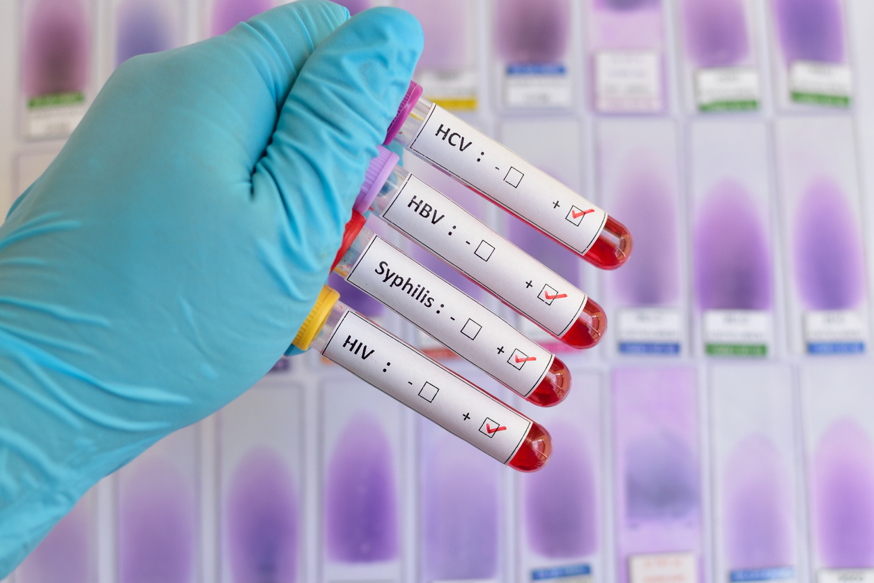 HIV-, HCV-, Syphilis- & HBV-Tests