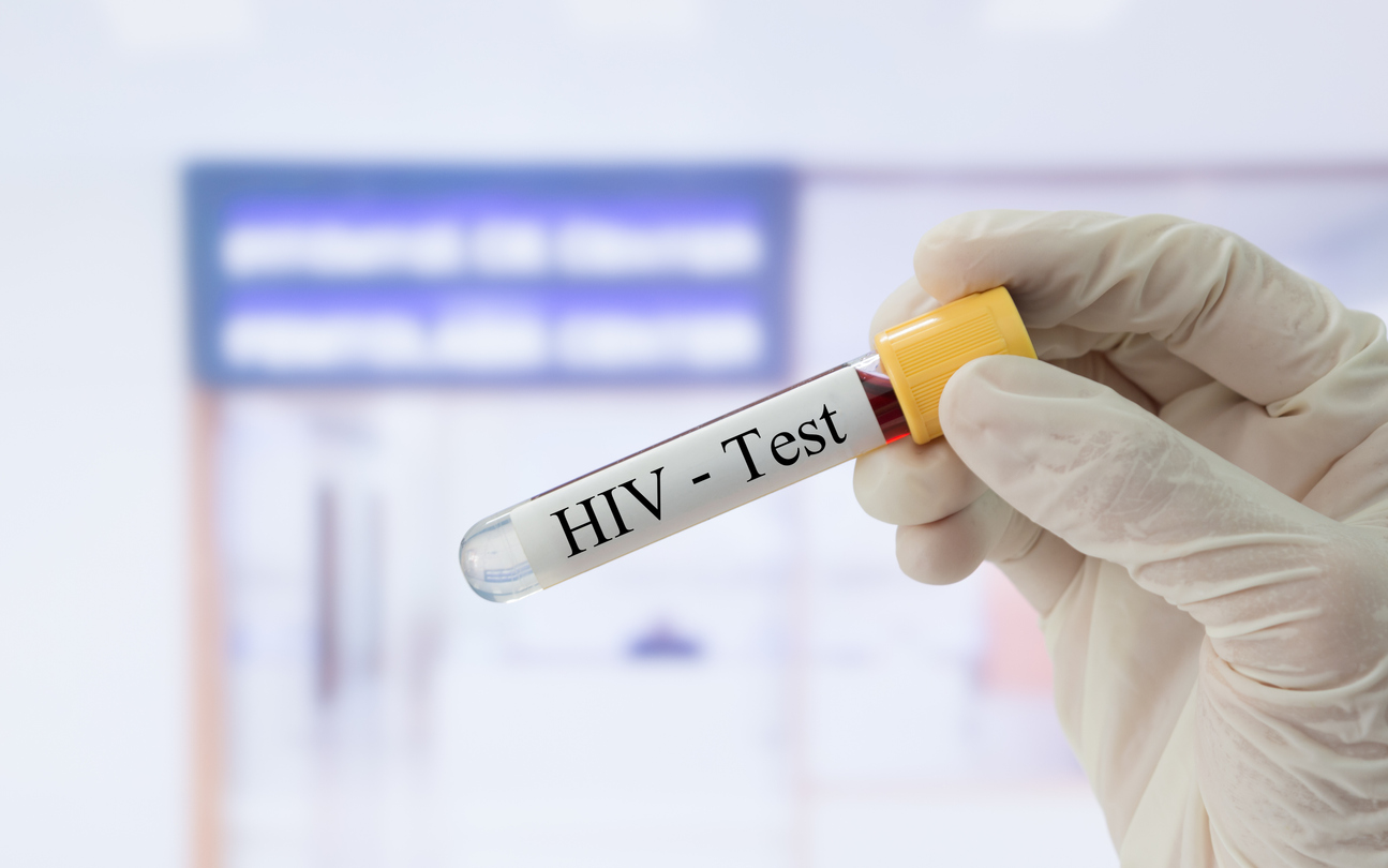 HIV-Test