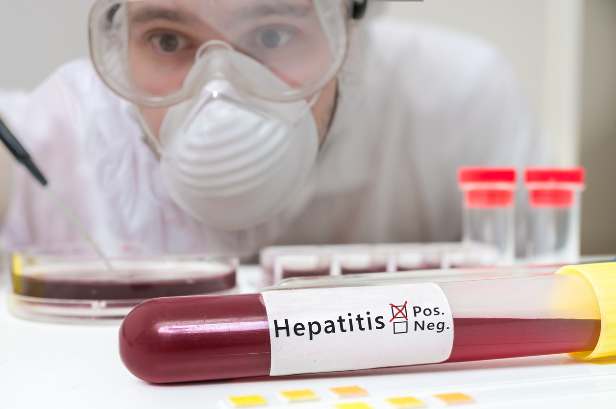 Hepatitis-Test