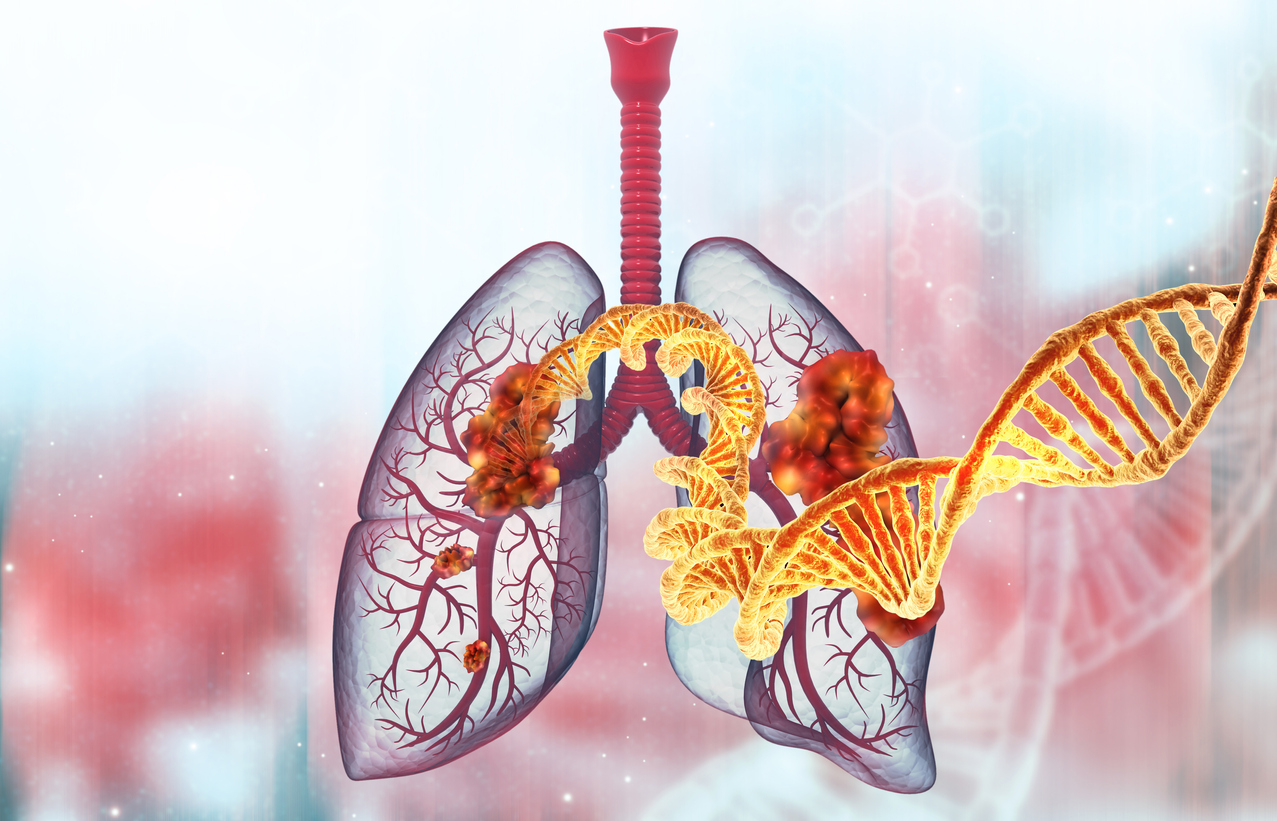 Lungenkrebs und DNA-Strang